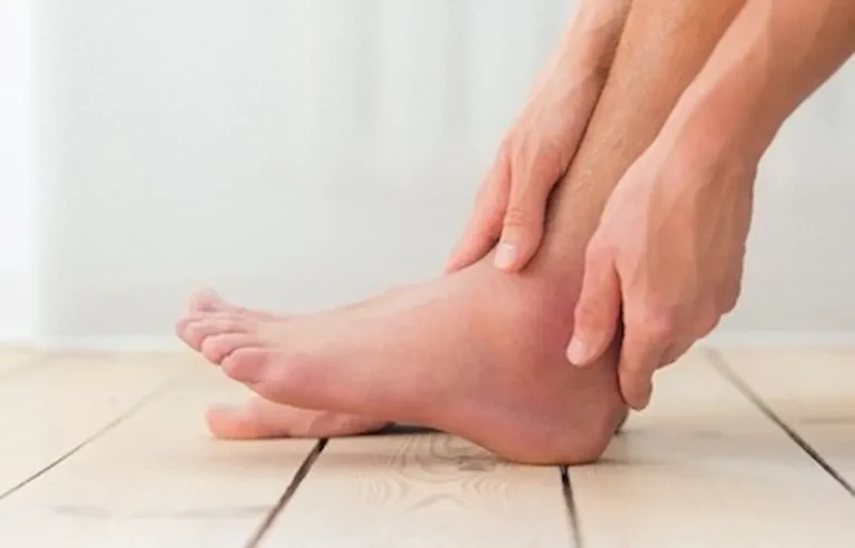 How to Get Rid of Swollen Ankles Fast?