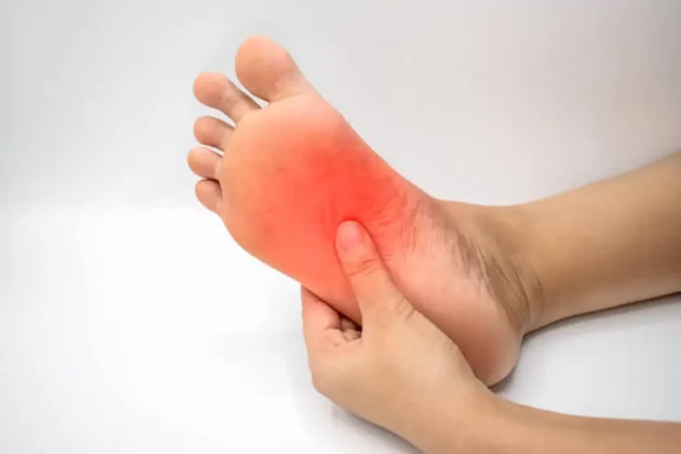 Burning Feet Syndrome is Caused by the Deficiency of